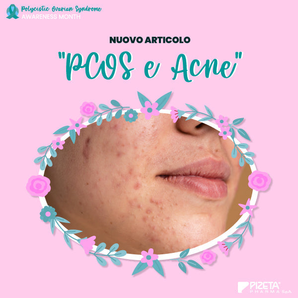 PCOS E ACNE